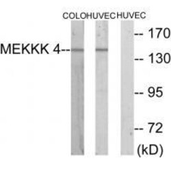 Invitrogen HGK Polyclonal Antibody 100 &mu;L | Buy Online | Invitrogen&trade; | Fisher Scientific
