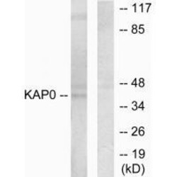 Invitrogen PRKAR1A Polyclonal Antibody 100 &mu;L; Unconjugated:Antibodies,