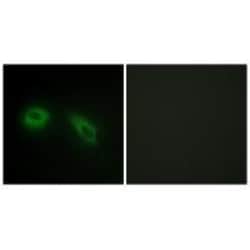 Invitrogen PRKCSH Polyclonal Antibody 100 &mu;L; Unconjugated:Antibodies,