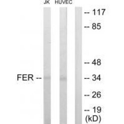 Invitrogen FER Polyclonal Antibody 100 &mu;L | Buy Online | Invitrogen&trade; | Fisher Scientific