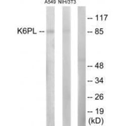 Invitrogen PFKL Polyclonal Antibody 100 &mu;L | Buy Online | Invitrogen&trade; | Fisher Scientific