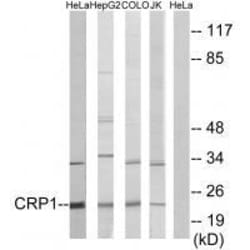 Invitrogen CRP1 Polyclonal Antibody 100 &mu;L; Unconjugated:Antibodies,