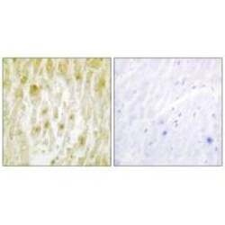 Invitrogen GTF2E2 Polyclonal Antibody 100 &mu;L; Unconjugated:Antibodies,