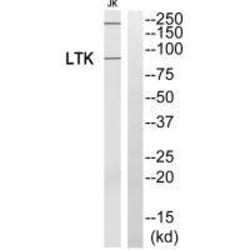 Invitrogen LTK Polyclonal Antibody 100 &mu;L | Buy Online | Invitrogen&trade; | Fisher Scientific