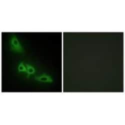 Invitrogen Glycerol kinase Polyclonal Antibody 100 &mu;L; Unconjugated:Antibodies,