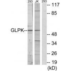 Invitrogen Glycerol kinase Polyclonal Antibody 100 &mu;L; Unconjugated:Antibodies,