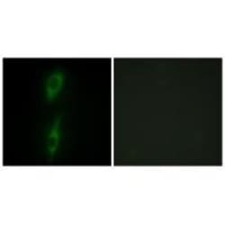 Invitrogen ACVRL1 Polyclonal Antibody 100 &mu;L; Unconjugated:Antibodies,
