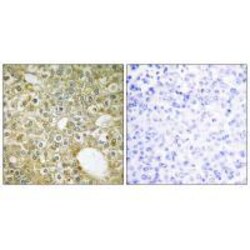 Invitrogen ACVRL1 Polyclonal Antibody 100 &mu;L; Unconjugated:Antibodies,