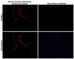Invitrogen ACVRL1 Polyclonal Antibody 100 &mu;L; Unconjugated:Antibodies,
