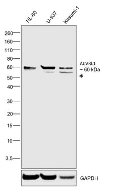 Invitrogen ACVRL1 Polyclonal Antibody 100 &mu;L; Unconjugated:Antibodies,