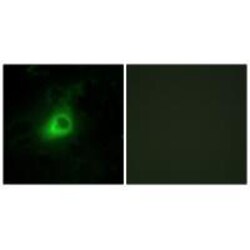 Invitrogen GRK6 Polyclonal Antibody 100 &mu;L; Unconjugated:Antibodies,