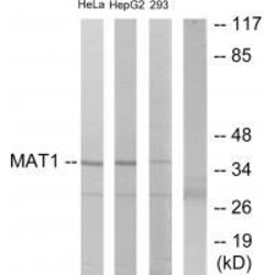 Invitrogen MNAT1 Polyclonal Antibody 100 &mu;L; Unconjugated:Antibodies,