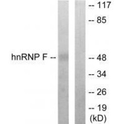Invitrogen hnRNP F Polyclonal Antibody 100 &mu;L; Unconjugated:Antibodies,