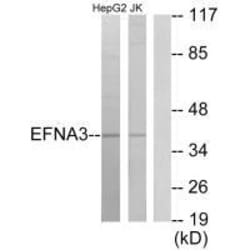 Invitrogen Ephrin A3 Polyclonal Antibody 100 &mu;L; Unconjugated:Antibodies,