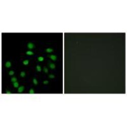 Invitrogen SCAND1 Polyclonal Antibody 100 &mu;L; Unconjugated:Antibodies,