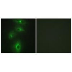 Invitrogen TMPRSS3 Polyclonal Antibody 100 &mu;L; Unconjugated:Antibodies,