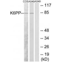 Invitrogen PFKP Polyclonal Antibody 100 &mu;L | Buy Online | Invitrogen&trade; | Fisher Scientific