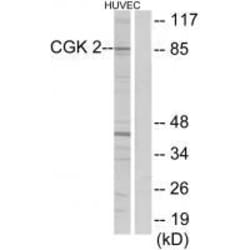 Invitrogen cGKII Polyclonal Antibody 100 &mu;L; Unconjugated:Antikroppar