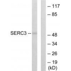 Invitrogen TDE1 Polyclonal Antibody 100 &mu;L | Buy Online | Invitrogen&trade; | Fisher Scientific