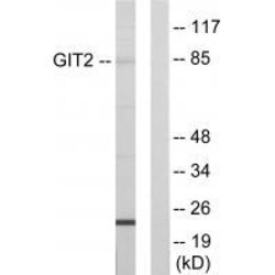 Invitrogen GIT2 Polyclonal Antibody 100 &mu;L | Buy Online | Invitrogen&trade; | Fisher Scientific