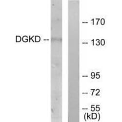 Invitrogen DGKD Polyclonal Antibody 100 &mu;L | Buy Online | Invitrogen&trade; | Fisher Scientific