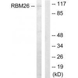 Invitrogen RBM26 Polyclonal Antibody 100 &mu;L | Buy Online | Invitrogen&trade; | Fisher Scientific