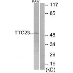 Invitrogen TTC23 Polyclonal Antibody 100 &mu;L | Buy Online | Invitrogen&trade; | Fisher Scientific