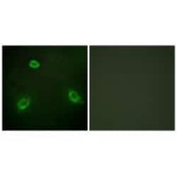 Invitrogen ANO7 Polyclonal Antibody 100 &mu;L; Unconjugated:Antibodies,