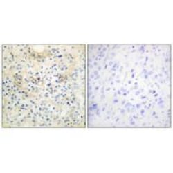 Invitrogen ANO7 Polyclonal Antibody 100 &mu;L; Unconjugated:Antibodies,