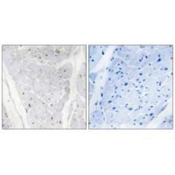 Invitrogen ALPK2 Polyclonal Antibody 100 &mu;L; Unconjugated:Antibodies,