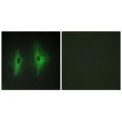 Invitrogen DGKH Polyclonal Antibody 100 &mu;L; Unconjugated:Antibodies,