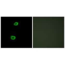 Invitrogen LMTK2 Polyclonal Antibody 100 &mu;L; Unconjugated:Antibodies,