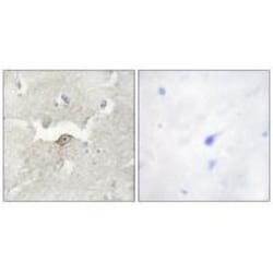 Invitrogen LMTK2 Polyclonal Antibody 100 &mu;L; Unconjugated:Antibodies,