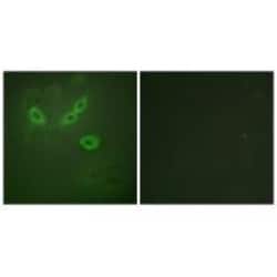 Invitrogen TUSC5 Polyclonal Antibody 100 &mu;L; Unconjugated:Antibodies,