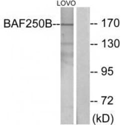 Invitrogen ARID1B Polyclonal Antibody 100 &mu;L; Unconjugated:Antibodies,