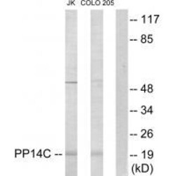 Invitrogen PPP1R14C Polyclonal Antibody 100 &mu;L | Buy Online | Invitrogen&trade; | Fisher Scientific