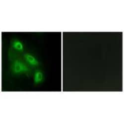 Invitrogen EPS8L3 Polyclonal Antibody 100 &mu;L | Buy Online | Invitrogen&trade; | Fisher Scientific
