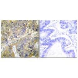 Invitrogen EPS8L3 Polyclonal Antibody 100 &mu;L | Buy Online | Invitrogen&trade; | Fisher Scientific