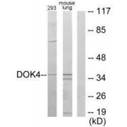 Invitrogen DOK4 Polyclonal Antibody 100 &mu;L | Buy Online | Invitrogen&trade; | Fisher Scientific