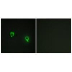 Invitrogen AKAP1 Polyclonal Antibody 100 &mu;L; Unconjugated:Antibodies,