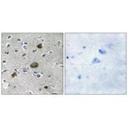 Invitrogen AKAP1 Polyclonal Antibody 100 &mu;L; Unconjugated:Antibodies,
