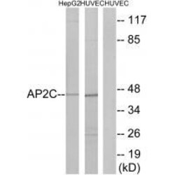 Invitrogen AP2 gamma Polyclonal Antibody 100 &mu;L | Buy Online | Invitrogen&trade; | Fisher Scientific