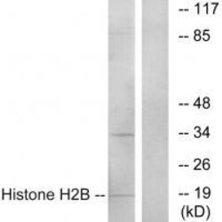 Invitrogen HIST1H2BH Polyclonal Antibody 100 &mu;L; Unconjugated:Antibodies,