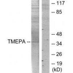 Invitrogen PMEPA1 Polyclonal Antibody 100 &mu;L | Buy Online | Invitrogen&trade; | Fisher Scientific
