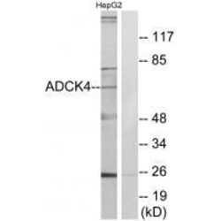 Invitrogen ADCK4 Polyclonal Antibody 100 &mu;L | Buy Online | Invitrogen&trade; | Fisher Scientific
