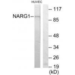 Invitrogen NAA15 Polyclonal Antibody 100 &mu;L | Buy Online | Invitrogen&trade; | Fisher Scientific