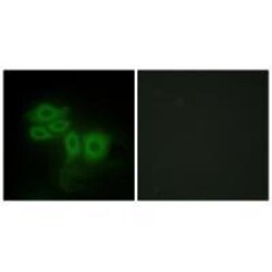 SLK Polyclonal Antibody, Invitrogen 100 &mu;L; Unconjugated:Antibodies,