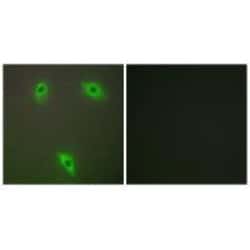 Invitrogen KLHL3 Polyclonal Antibody 100 &mu;L; Unconjugated:Antibodies,