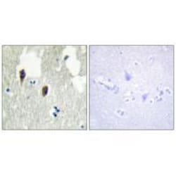 Invitrogen KLHL3 Polyclonal Antibody 100 &mu;L; Unconjugated:Antibodies,