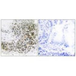 Invitrogen TRPS1 Polyclonal Antibody 100 &mu;L; Unconjugated:Antibodies,